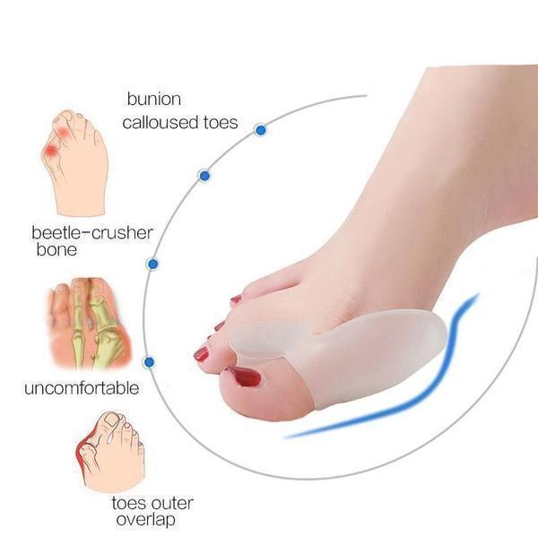 BunionFree™ Bunion Guard Toe Spacer - Bunion Free