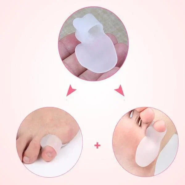 BunionFree™ Bunionette Corrector - Bunion Free