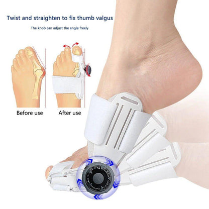 Flexible Bunion Corrector Brace - ComfyFootgear